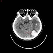 Biomedical Science &, Research Biomedical Science &, Research